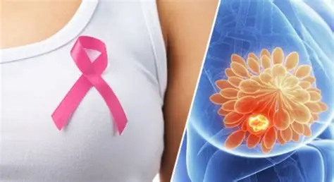 Aumentan detecciones de tumores malignos de mama en hospitales de Puebla