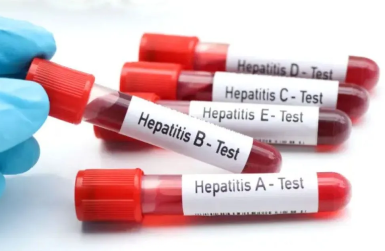 Puebla se ubica entre los 10 estados con más casos de hepatitis A y B